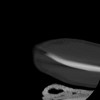 SPORK, NICO - 22.03.1976 - 02.08.2022 - CT obere Extremität - 17:59:38